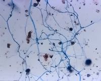 mycorrhiza